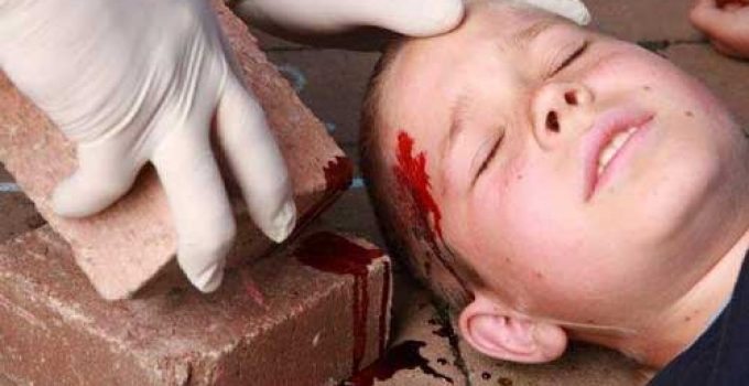 KAFATASI BEYİN YARALANMALARI