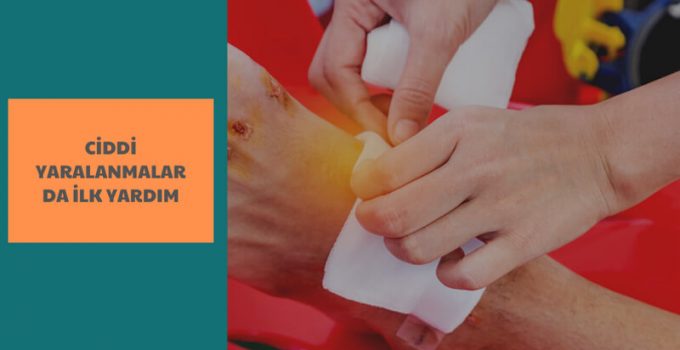 CİDDİ YARALANMALARDA İLK YARDIM NASIL OLMALIDIR?