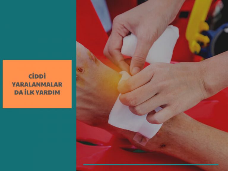 Ciddi yaralanmalarda ilk yardım