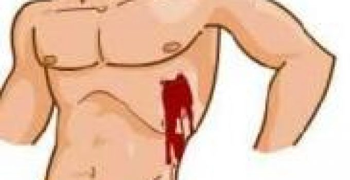 DELİCİ GÖĞÜS YARALANMALARI