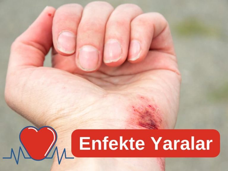 Enfekte Yara