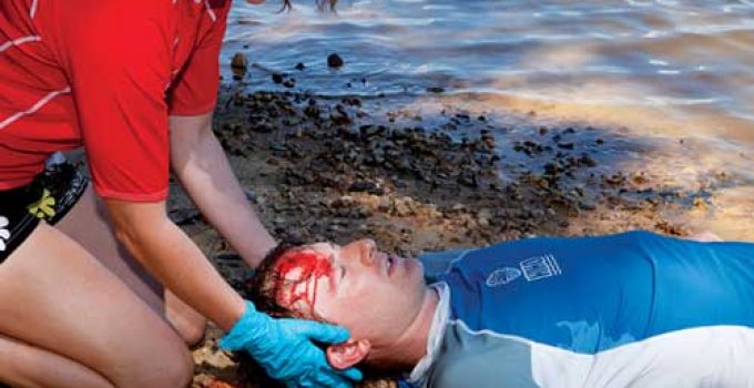 KAFATASI VE OMURGA YARALANMALARINDA İLK YARDIM NASIL OLMALIDIR?