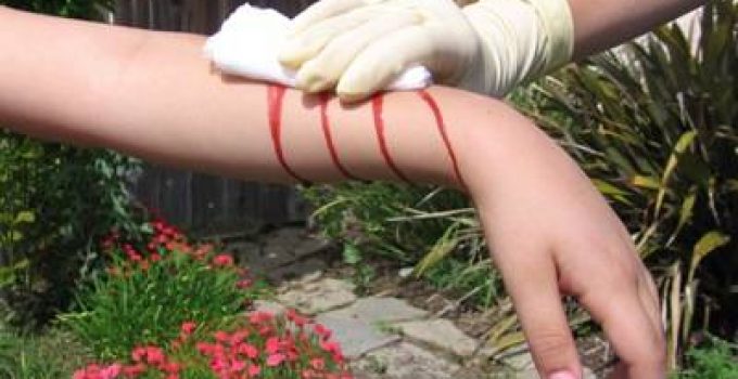 Kanama Nedir? Kanama Nedir?