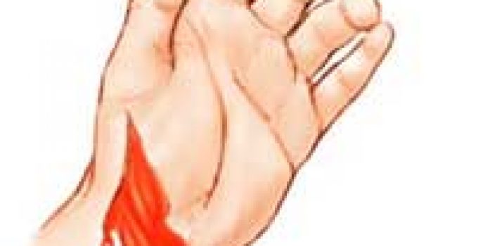 TOPLAR DAMAR KANAMASI TOPLAR DAMAR KANAMASI